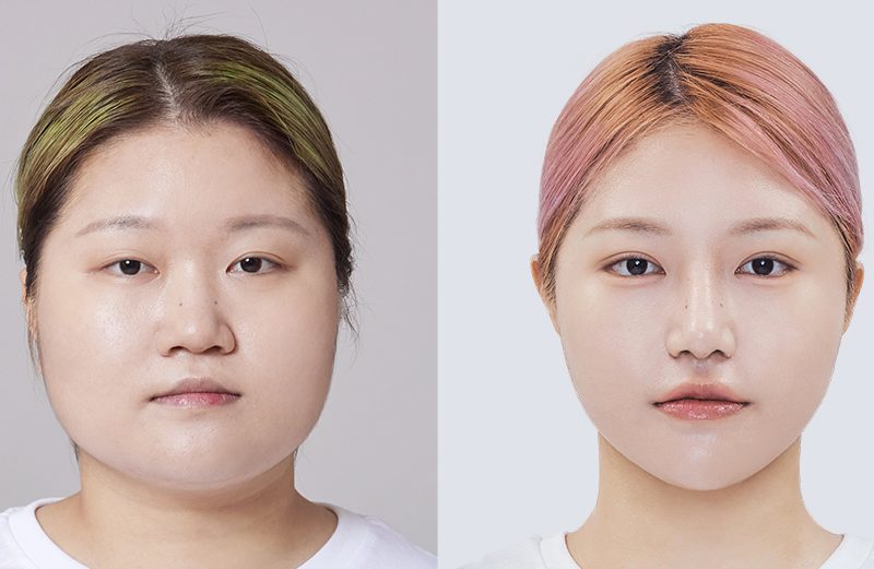 美容施術完全ガイド：フェイシャル・二重整形・痩身の効果・費用・注意点